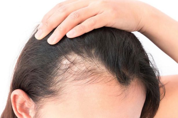 Como fazer o cabelo feminino crescer nas entradas, dicas e tratamentos.